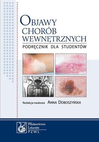 Objawy chorób wewnętrznych. Podręcznik dla studentów Anna Doboszyńska - okladka książki