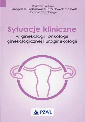 Sytuacje kliniczne w ginekologii onkologii ginekologicznej i uroginekologii Ewa Nowak-Markwitz, Grzegorz Bręborowicz, Tomasz Rechberger - okladka książki