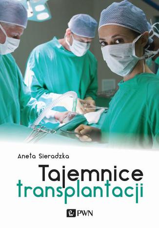 Tajemnice transplantacji Aneta Sieradzka - okladka książki