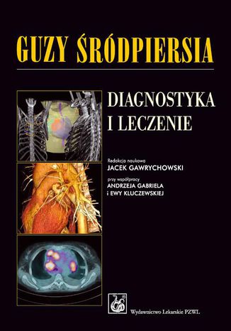 Guzy śródpiersia. Diagnostyka i leczenie Jacek Gawrychowski - okladka książki