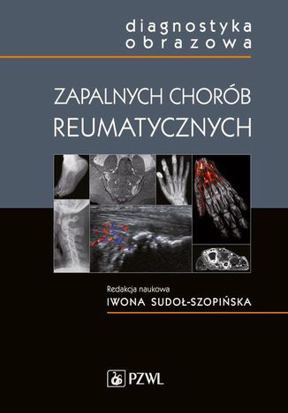 Diagnostyka obrazowa zapalnych chorób reumatycznych Iwona Sudoł-Szopińska - okladka książki