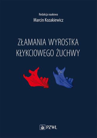 Złamania wyrostka kłykciowego żuchwy Marcin Kozakiewicz - okladka książki