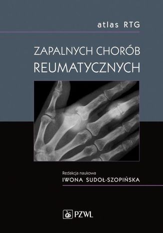 Atlas RTG zapalnych chorób reumatycznych Iwona Sudoł-Szopińska - okladka książki