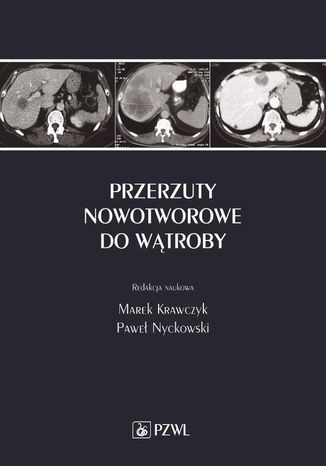 Przerzuty nowotworowe do wątroby Marek Krawczyk, Paweł Nyckowski - okladka książki