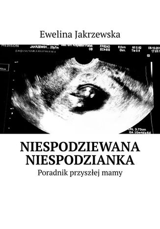 Niespodziewana Niespodzianka. Poradnik przyszłej mamy Ewelina Jakrzewska - okladka książki