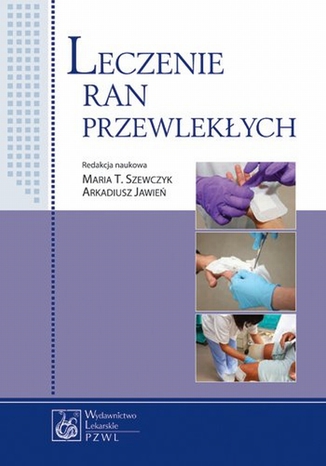 Leczenie ran przewlekłych Maria T. Szewczyk - okladka książki