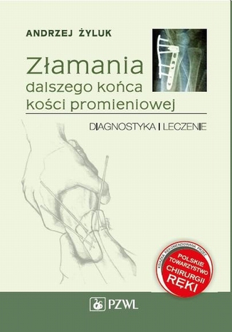 Złamania dalszego końca kości promieniowej. Diagnostyka i leczenie Andrzej Żyluk - okladka książki