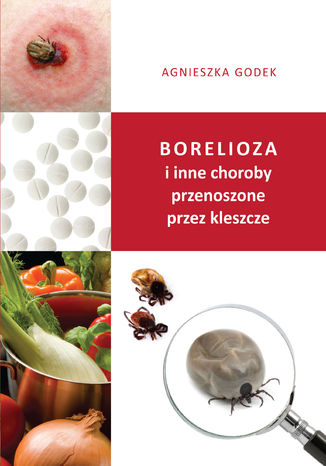 Borelioza i inne choroby przenoszone przez kleszcze Agnieszka Godek - okladka książki