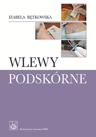 Wlewy podskórne Izabela Bętkowska - okladka książki