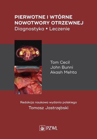 Pierwotne i wtórne nowotwory otrzewnej Tomasz Jastrzębski - okladka książki