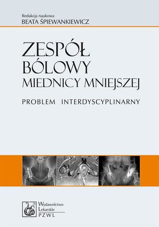 Zespół bólowy miednicy mniejszej. Problem interdyscyplinarny Beata Śpiewankiewicz - okladka książki