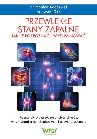 Przewlekłe stany zapalne. Jak je rozpoznać i wyeliminować Monica Aggarwal - okladka książki