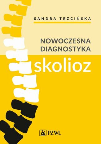 Nowoczesna diagnostyka skolioz Sandra Trzcińska, Kamil Koszela, Andrzej Myśliwiec, Arkadiusz Żurawski - okladka książki