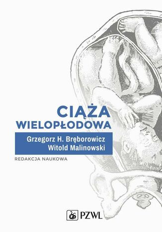 Ciąża wielopłodowa Grzegorz H. Bręborowicz, Witold Malinowski - okladka książki