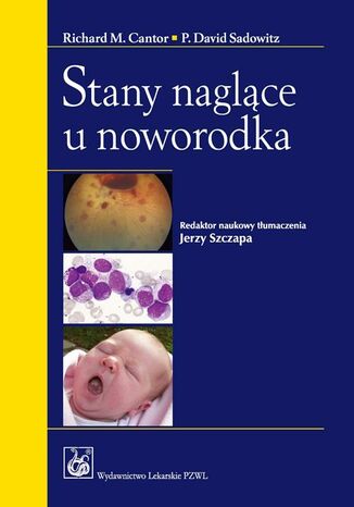 Stany naglące u noworodka Richard M. Cantor, P. David Sadowitz - okladka książki