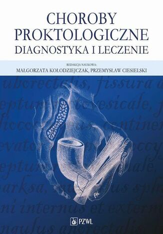 Choroby proktologiczne Małgorzata Kołodziejczak, Przemysław Ciesielski - okladka książki