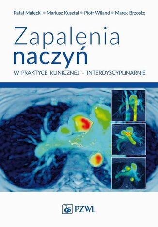 Zapalenia naczyń w praktyce klinicznej interdyscyplinarnie Rafał Małecki, Mariusz Kusztal, Piotr Wiland, Marek Brzosko - okladka książki