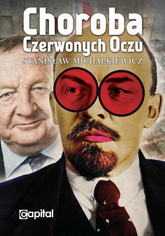 Choroba czerwonych oczu Stanisław Michalkiewicz - okladka książki