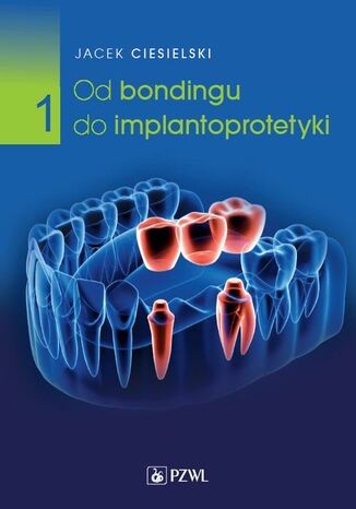 Od bondingu do implantoprotetyki Część 1 Jacek Ciesielski - okladka książki