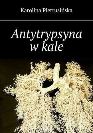 Antytrypsyna w kale Karolina Pietrusińska - okladka książki