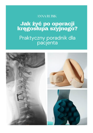 Jak żyć po operacji kręgosłupa szyjnego? Praktyczny poradnik dla pacjenta Anna Rubik - okladka książki