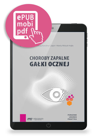 Choroby zapalne gałki ocznej - poradnik lekarza praktyka Karolina Czajor, Marta Misiuk-Hojło - okladka książki