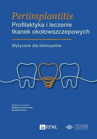 Periimplantitis Profilaktyka i leczenie tkanek okołowszczepowych Renata Górska, Elżbieta Dembowska - okladka książki