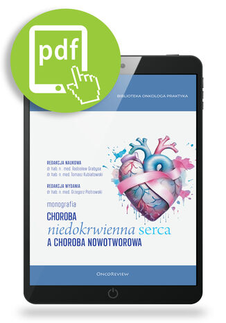Choroba niedokrwienna serca a choroba nowotworowa Pod redakcją dr hab. n med. Grzegorza Piotrowskiego - okladka książki