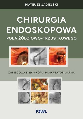 Chirurgia endoskopowa pola żółciowo-trzustkowego Mateusz Jagielski - okladka książki