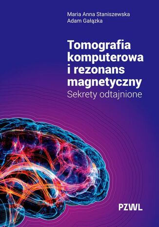 Tomografia komputerowa i rezonans magnetyczny Maria Anna Staniszewska, Adam Gałązka - okladka książki